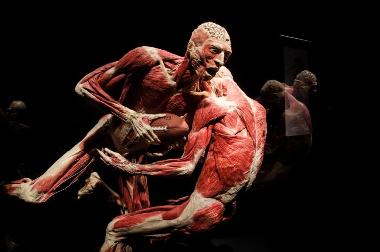 Museum Aims to Come Alive With Cadaver Show